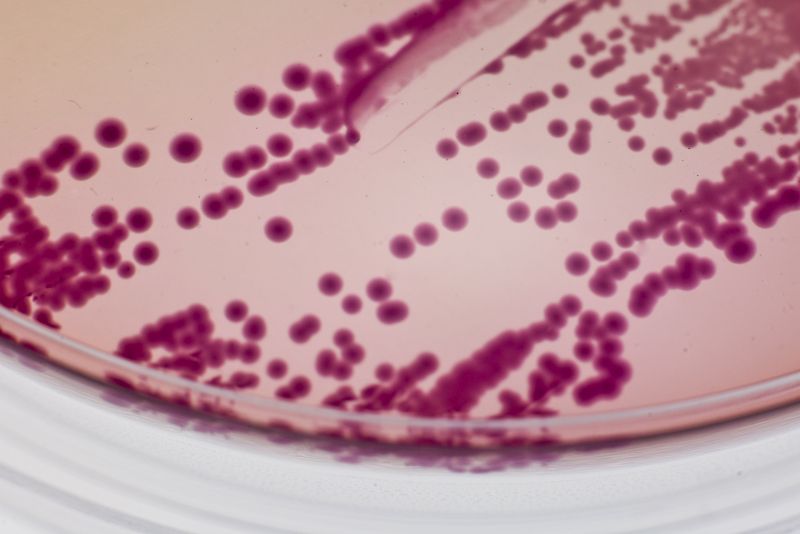 Ginos Beinoravičiūtės nuotrauka A. baumannii bakterijos