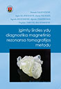 Igimtu sirdies ydu diagnostika