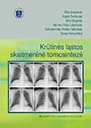 Krutines lastosTomosinteze