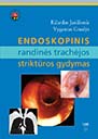 endoskop randines trachejos gydymas