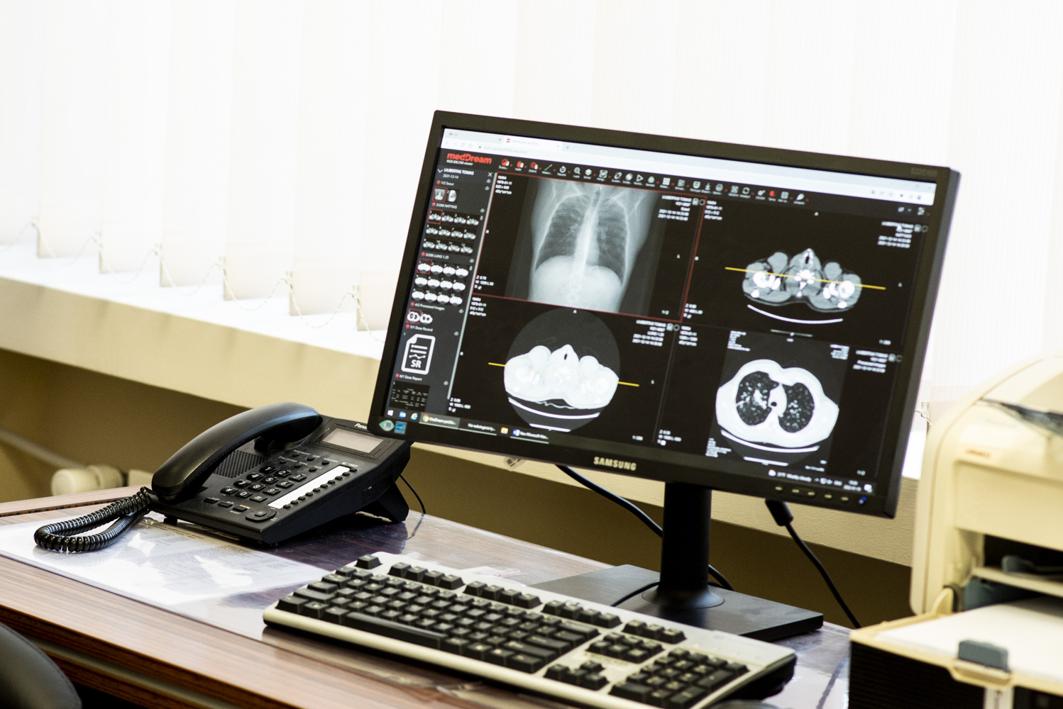 Lung Cancer Diagnostics 